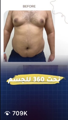مقطع من حساب عميل حقّق 709 ألف مشاهدة · a client clip with 709K views