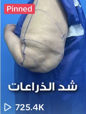 مقطع من حساب عميل حقّق 725.4 ألف مشاهدة · a client clip with 725.4K views